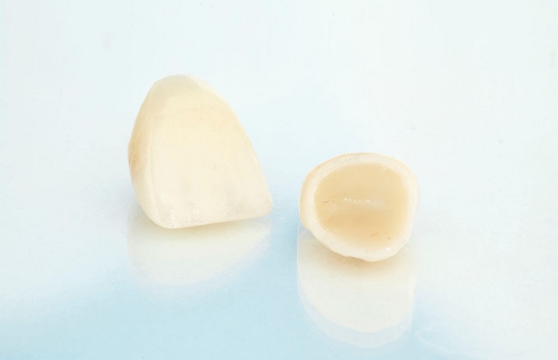 https://www.ebenezerdental.com/restorative/porcelain-crowns/